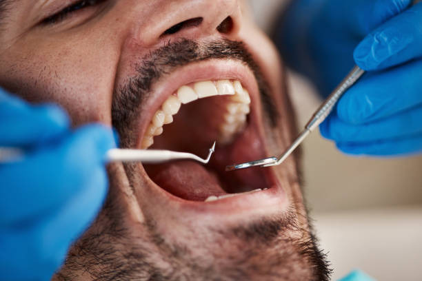 Best Emergency Dental Services for Seniors in North Bonneville, WA